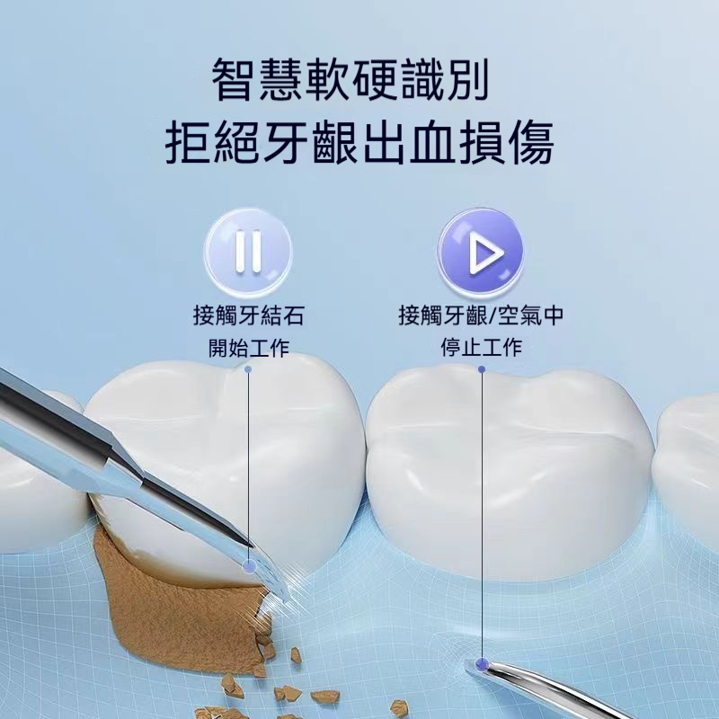 超聲波潔牙機